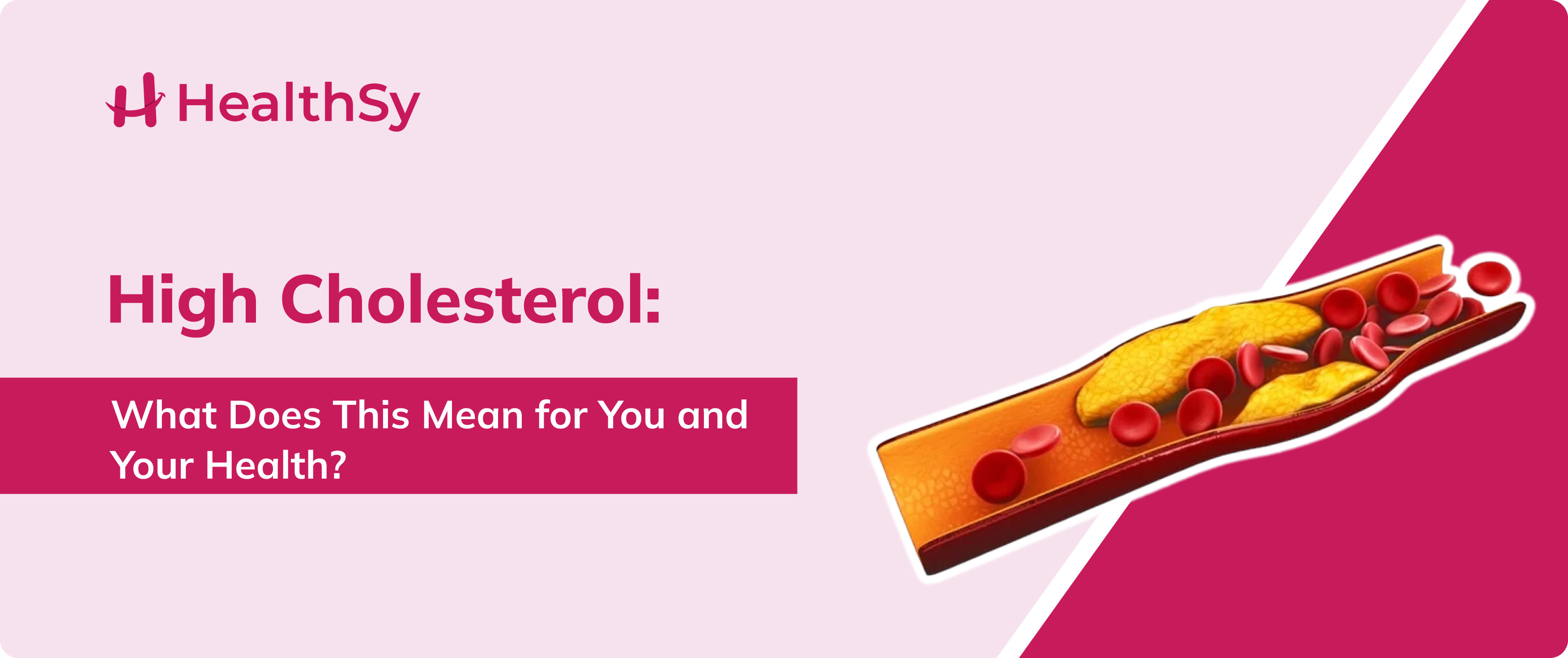 high-cholesterol-what-does-this-mean-for-you-and-your-health