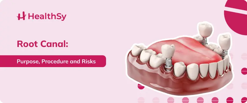 Root Canal: Purpose, Procedure and Risks