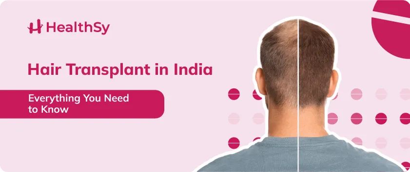 hair-transplant-in-india-everything-you-need-to-know