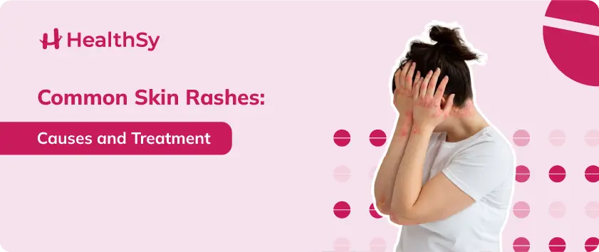 Common Skin Rashes: Causes and Treatment