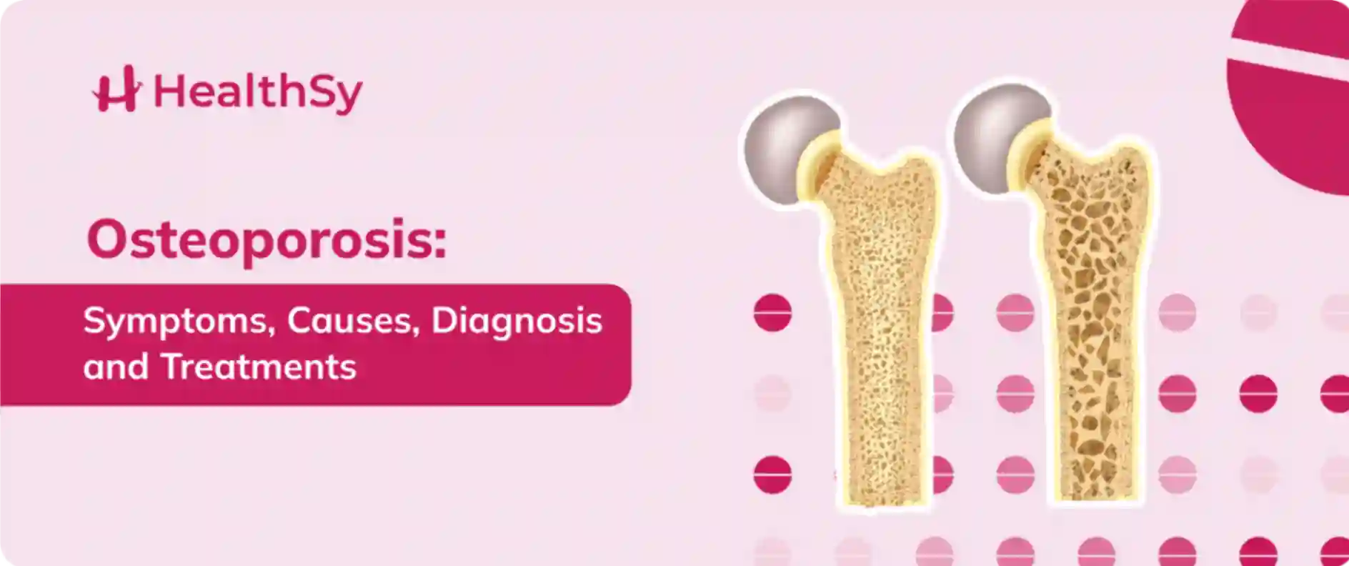 osteoporosis-symptoms-causes-diagnosis-and-treatment