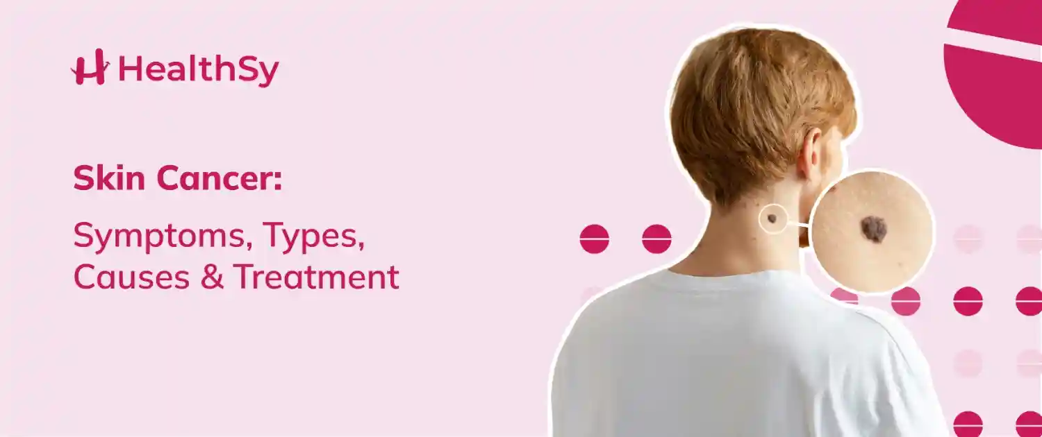 skin-cancer-symptoms-types-causes-treatment